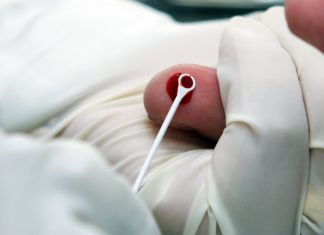 Saúde realiza teste de hepatites virais neste sábado