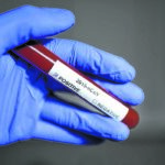 testecorona2