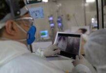 Covid-19 em Olímpia: uma morte após 70 dias e aumento de 25% nos casos