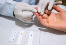 Olímpia oferece testes gratuitos para hepatites neste sábado (1º)